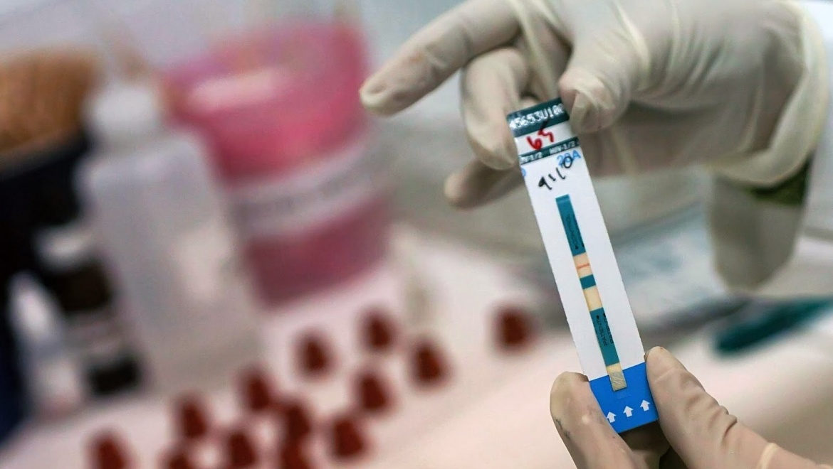Казанцы смогут пройти бесплатное анонимное тестирование на ВИЧ-инфекцию