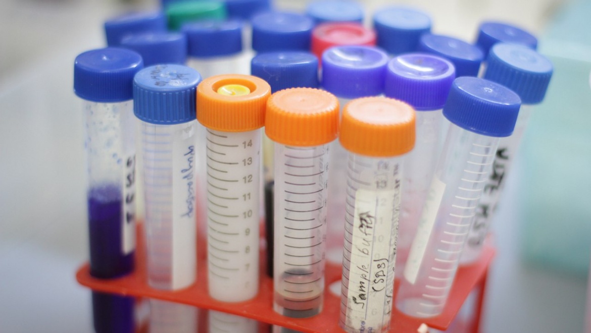 В КФУ создается первое в России опытное производство генных препаратов