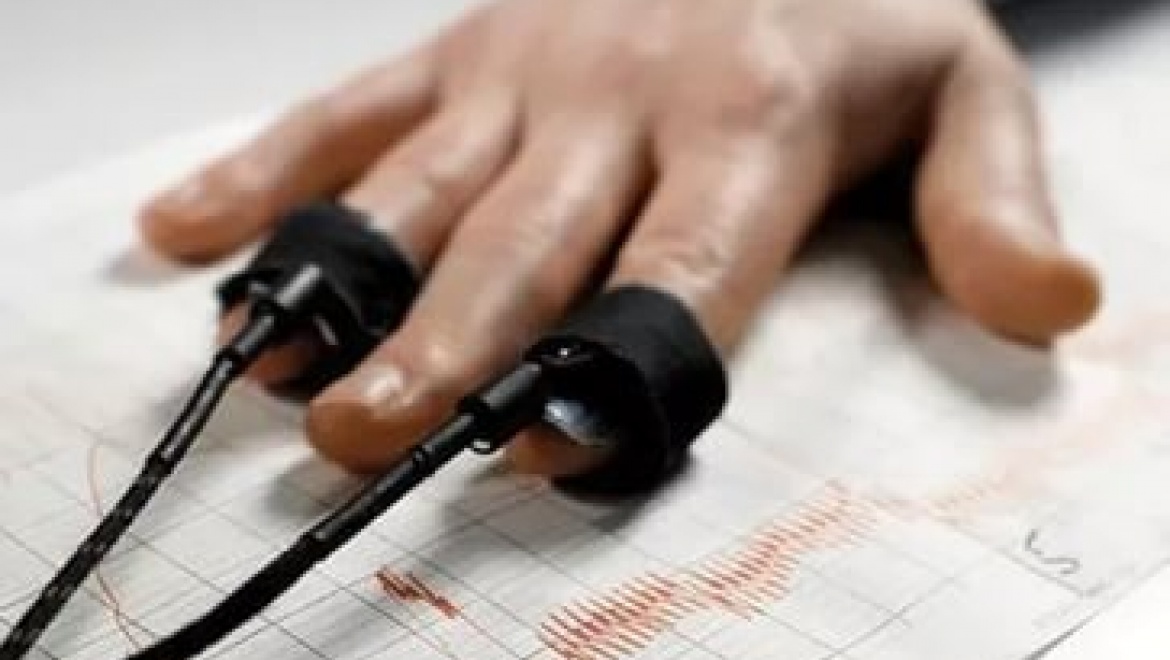 Живодера направили на психиатрическую экспертизу