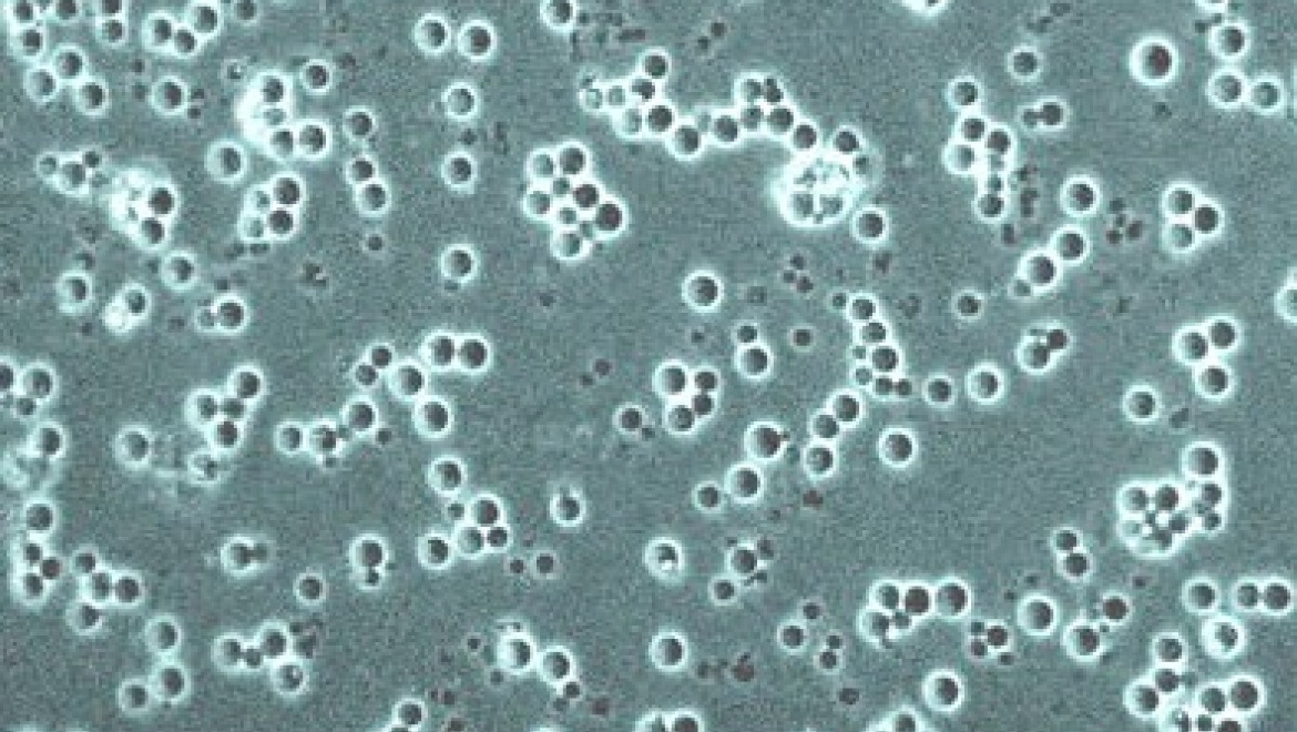 Казанские ученые обнаружили штамм дрожжей, способных нейтрализовать нефтяные отходы